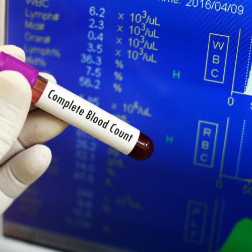 Blutwerte – 5 Werte, die dein Arzt nicht testet